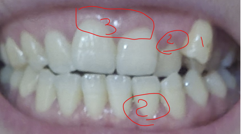 4ad524c676775f13b6d1a973713caa6a_1735167119_4.png