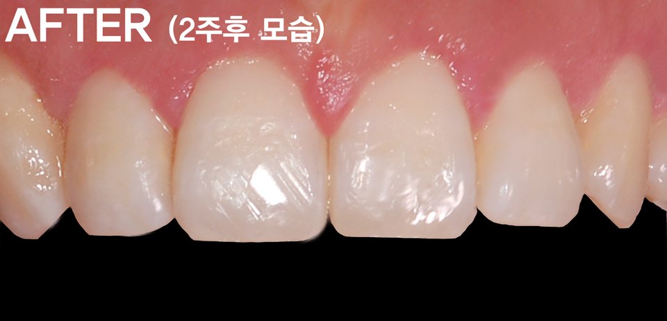 9427e51e8147cc4490a1cb0224ffffe5_1743203333_57.jpg