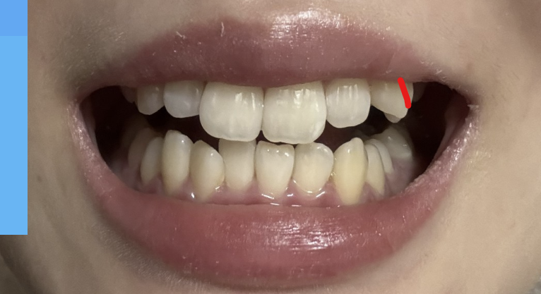 9477ad60d068ede7091ae17820882699_1763241662_82.png 9477ad60d068ede7091ae17820882699_1763241662_82.png