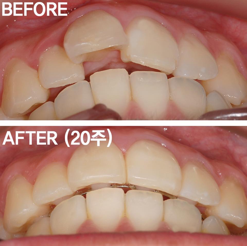 6fdcc67fd16e56731cf613519a036aac_1764976265_74.jpg 6fdcc67fd16e56731cf613519a036aac_1764976265_74.jpg