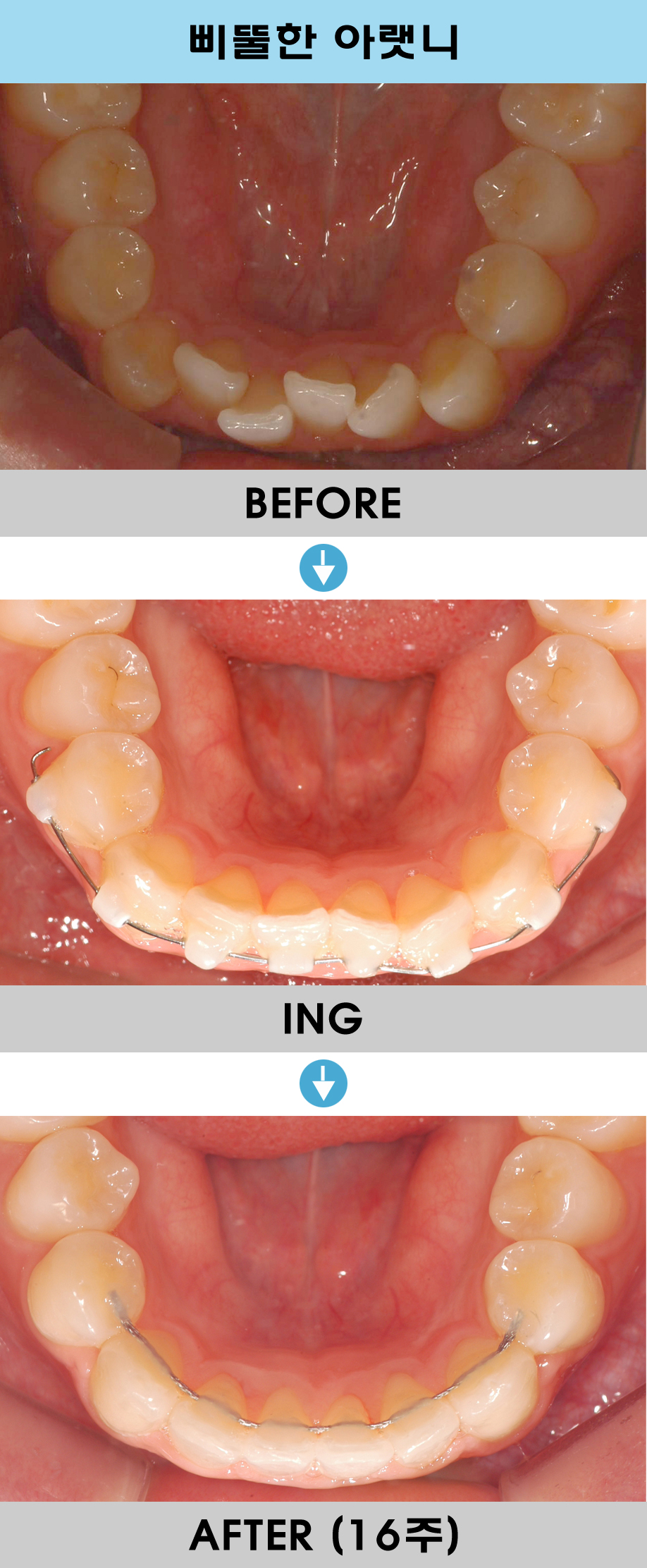 6fdcc67fd16e56731cf613519a036aac_1764976326_57.jpg 6fdcc67fd16e56731cf613519a036aac_1764976326_57.jpg