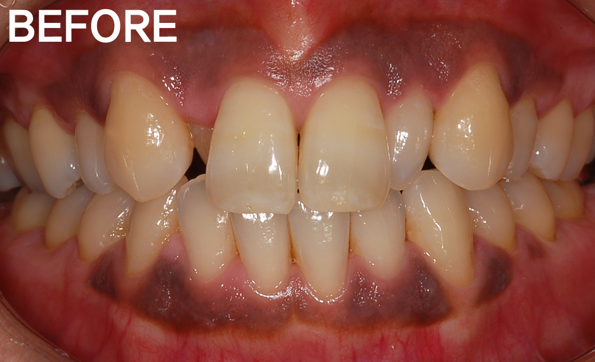 958743a930535a7318aefc90f1c12952_1768862979_42.jpg 958743a930535a7318aefc90f1c12952_1768862979_42.jpg