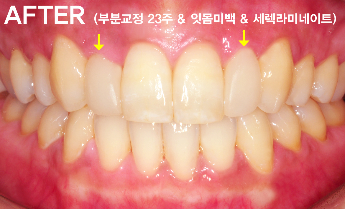 958743a930535a7318aefc90f1c12952_1768862979_71.jpg 958743a930535a7318aefc90f1c12952_1768862979_71.jpg